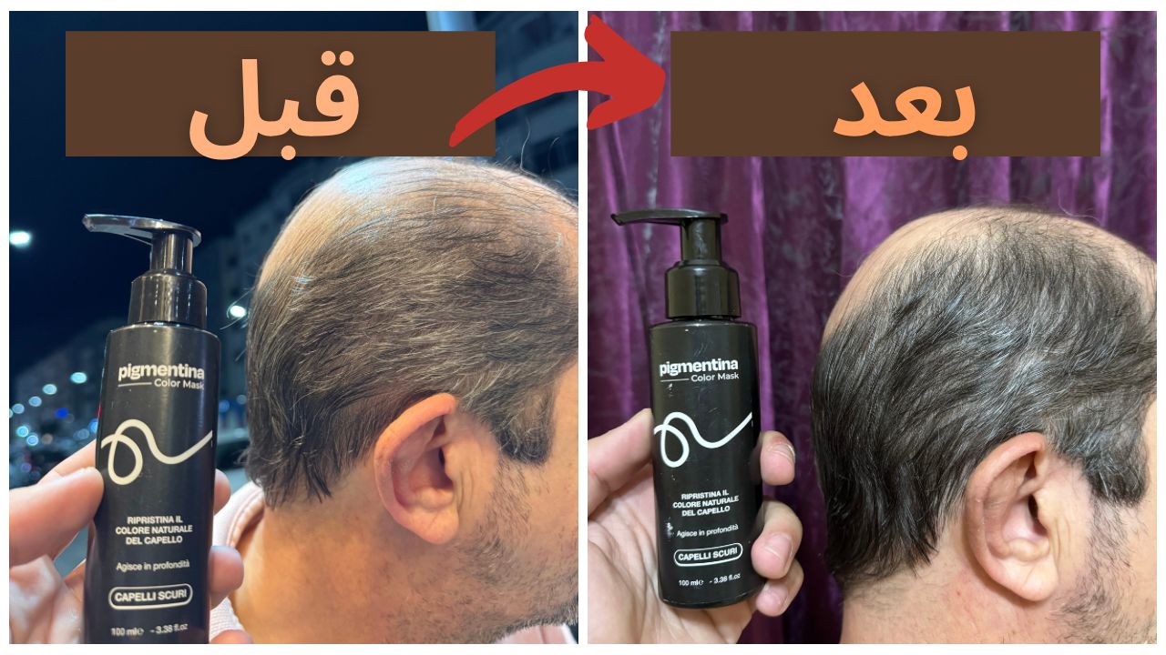 شامبو Pigmentina ضد الشيب